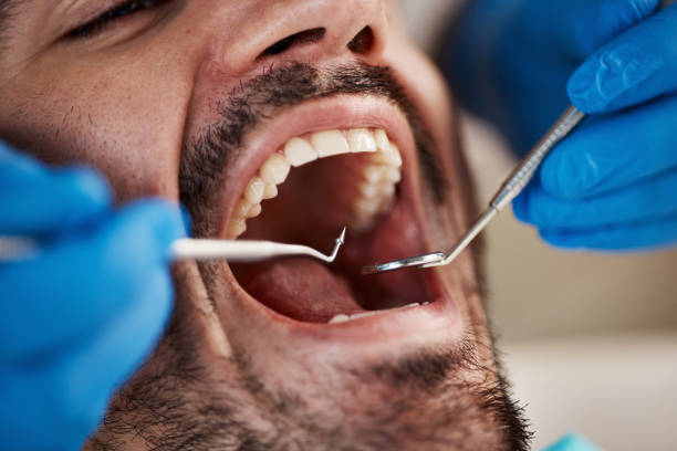 Best Emergency Cosmetic Dentistry in Statesboro, GA