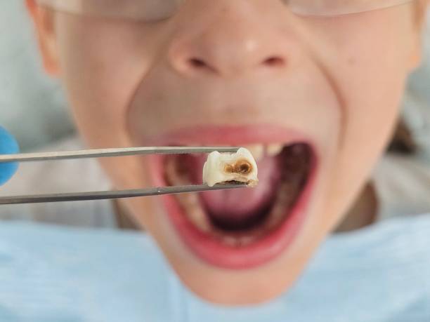 Best Orthodontic Emergency Dentist in Statesboro, GA